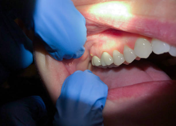 Best Emergency Dental Care for Sports Injuries in Loretto, TN